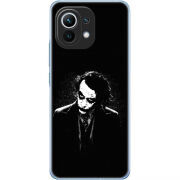 Чехол BoxFace Xiaomi Mi 11 