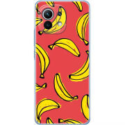 Чехол BoxFace Xiaomi Mi 11 