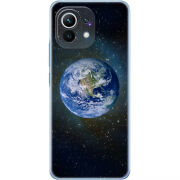 Чехол BoxFace Xiaomi Mi 11 