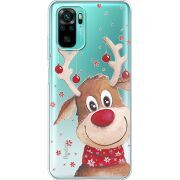 Прозрачный чехол BoxFace Xiaomi Redmi Note 10/ Note 10S Winter Deer