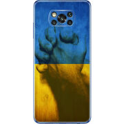 Чехол BoxFace Poco X3 Pro Handshake