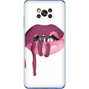 Чехол BoxFace Poco X3 Pro 