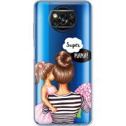 Прозрачный чехол BoxFace Xiaomi Poco X3 Pro Super Mama and Daughter