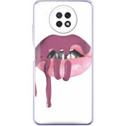 Чехол BoxFace Xiaomi Redmi Note 9T 