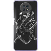 Чехол BoxFace Xiaomi Redmi Note 9T 