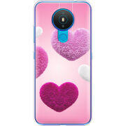 Чехол BoxFace Nokia 1.4 