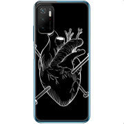 Чехол BoxFace Xiaomi Poco M3 Pro 