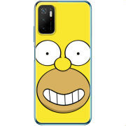 Чехол BoxFace Xiaomi Poco M3 Pro 