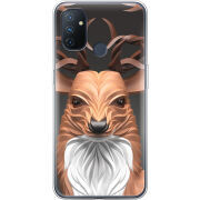 Чехол BoxFace OnePlus Nord N100 