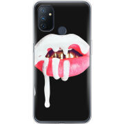 Чехол BoxFace OnePlus Nord N100 