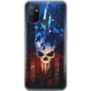 Чехол BoxFace OnePlus Nord N100 