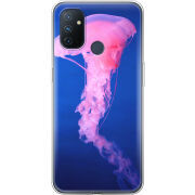 Чехол BoxFace OnePlus Nord N100 