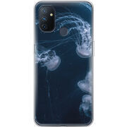 Чехол BoxFace OnePlus Nord N100 