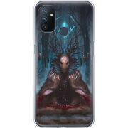 Чехол BoxFace OnePlus Nord N100 