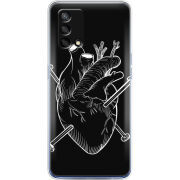 Чехол BoxFace OPPO A74 