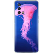 Чехол BoxFace OPPO A74 