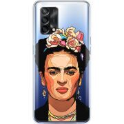 Прозрачный чехол BoxFace OPPO A74 Фрида Кало
