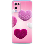 Чехол BoxFace OPPO A54 