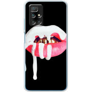 Чехол BoxFace Xiaomi Redmi 10 