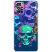 Чехол BoxFace Xiaomi Redmi 10 