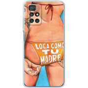 Чехол BoxFace Xiaomi Redmi 10 