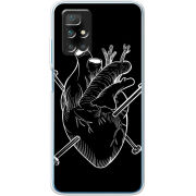 Чехол BoxFace Xiaomi Redmi 10 