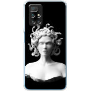 Чехол BoxFace Xiaomi Redmi 10 