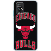 Чехол BoxFace Xiaomi Redmi 10 