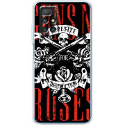 Чехол BoxFace Xiaomi Redmi 10 