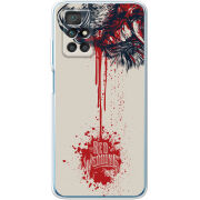 Чехол BoxFace Xiaomi Redmi 10 