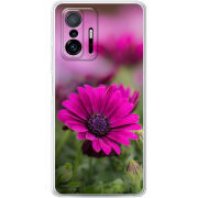 Чехол BoxFace Xiaomi 11T / 11T Pro 