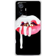 Чехол BoxFace Xiaomi 11T / 11T Pro 