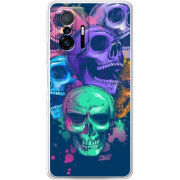Чехол BoxFace Xiaomi 11T / 11T Pro 