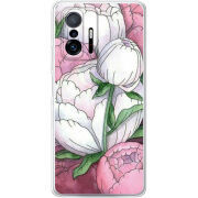 Чехол BoxFace Xiaomi 11T / 11T Pro 