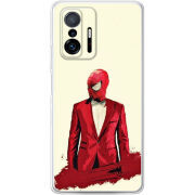 Чехол BoxFace Xiaomi 11T / 11T Pro 