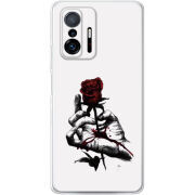 Чехол BoxFace Xiaomi 11T / 11T Pro 