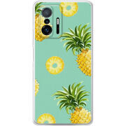 Чехол BoxFace Xiaomi 11T / 11T Pro 