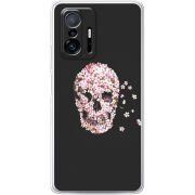 Чехол BoxFace Xiaomi 11T / 11T Pro 