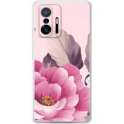 Чехол BoxFace Xiaomi 11T / 11T Pro 