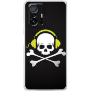 Чехол BoxFace Xiaomi 11T / 11T Pro 