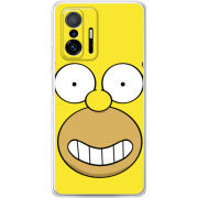 Чехол BoxFace Xiaomi 11T / 11T Pro 