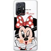 Прозрачный чехол BoxFace Xiaomi 11T / 11T Pro Lady M