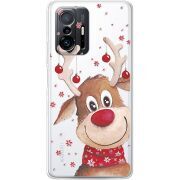 Прозрачный чехол BoxFace Xiaomi 11T / 11T Pro Winter Deer