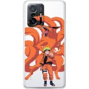 Прозрачный чехол BoxFace Xiaomi 11T / 11T Pro Naruto and Kurama