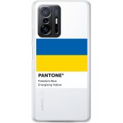 Прозрачный чехол BoxFace Xiaomi 11T / 11T Pro Pantone вільний синій