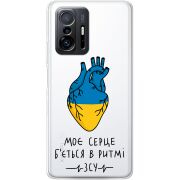 Прозрачный чехол BoxFace Xiaomi 11T / 11T Pro Моє серце в ритмі ЗСУ
