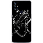 Чехол BoxFace OnePlus Nord N10 