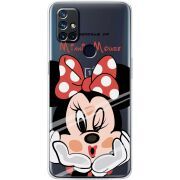 Прозрачный чехол BoxFace OnePlus Nord N10 Lady M