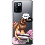 Прозрачный чехол BoxFace Xiaomi Poco X3 GT Super Mama and Daughter