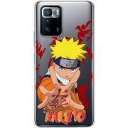 Прозрачный чехол BoxFace Xiaomi Poco X3 GT Naruto